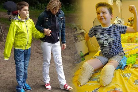Раненный в Донбассе Ваня Воронов вновь учится ходить