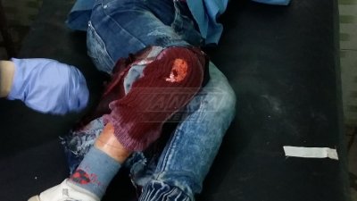 Молния. 21+:Обстрел Университета Алеппо