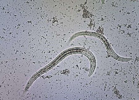 В Австралии "инопланетные" черви-паразиты начали убивать тысячи людей