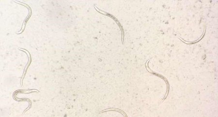 В Австралии "инопланетные" черви-паразиты начали убивать тысячи людей