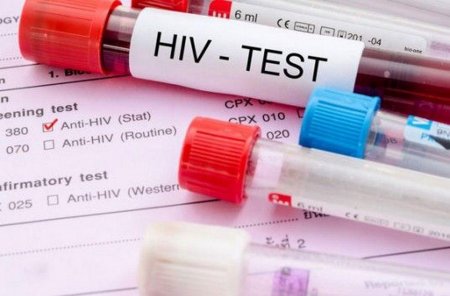 "Уже совсем близко": Вакцину против ВИЧ готовят к проверке на людях