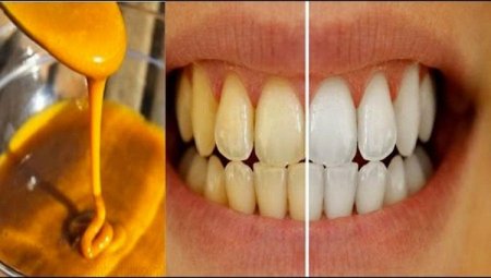 Эксперты: Куркума отбеливает зубы и снижает вес