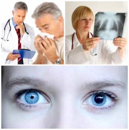 Рак по зрачкам: Учёные научились по глазам диагностировать смертельное забо ...