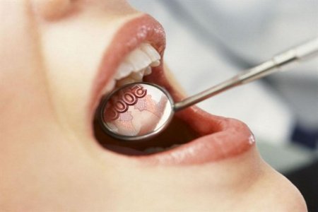 Монетный зуб: Мясников рассказал, как поставить зубные импланты за 1 день