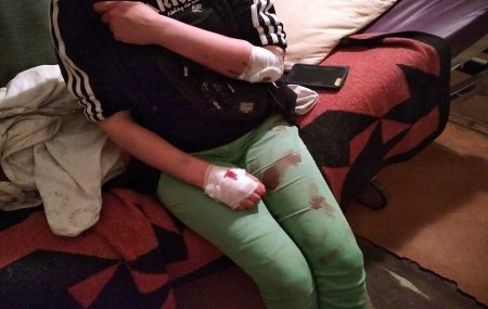 Во Львове неизвестные с арматурой напали на группу активистов