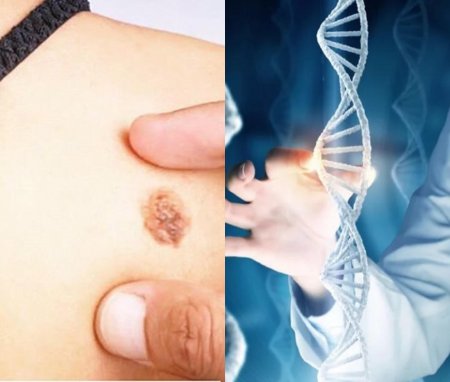 Найден белок, связанный с геном рака кожи